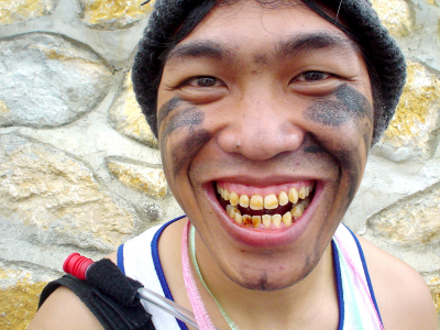 Why are my Teeth Yellow?