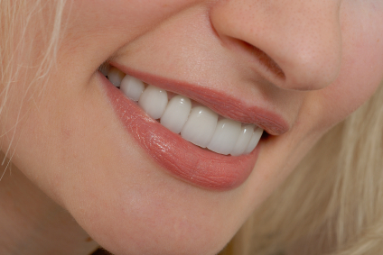 What Are Porcelain Veneers Dentists 