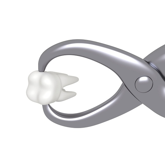 Relieve Tooth Extraction Pain Dentists TalkLocal Blog — Talk Local Blog