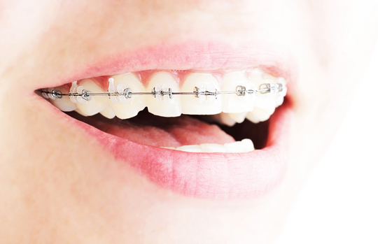 What Do Orthodontists Do? - Dentists