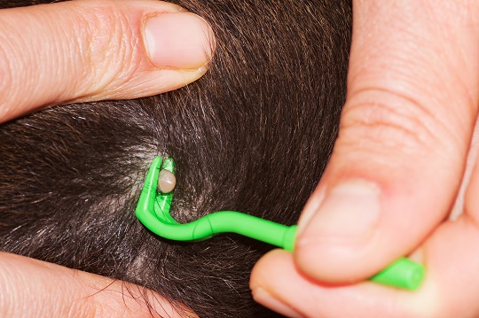 How to Remove Dog Ticks